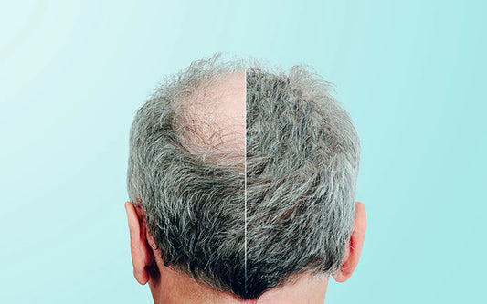 "Unlock the Secrets to Luscious Locks: A Comprehensive Guide to Healthy Hair Growth"
